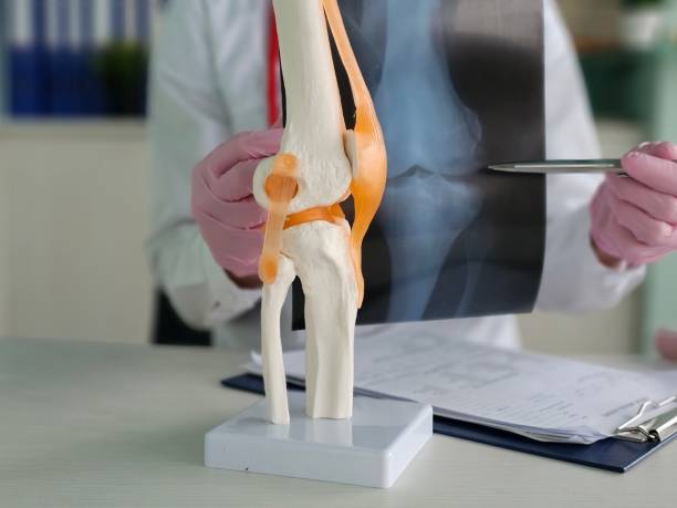 istock Doctor examines knee joint model while discussing X-ray results 2189771992