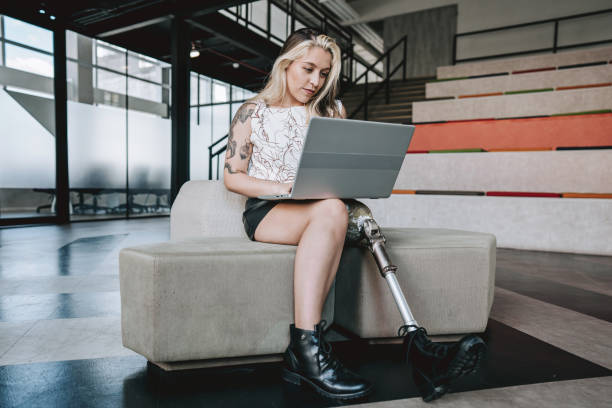istock Woman with prosthetic leg working on laptop 2190213776