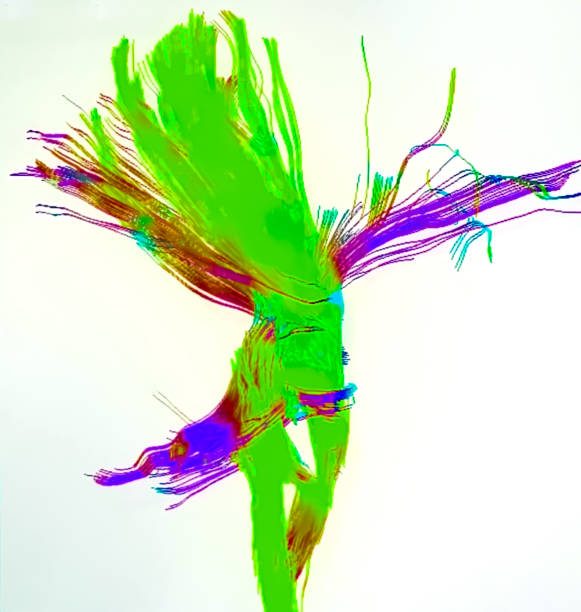 istock Magnetic Resonance Diffusion Tensor Imaging (MR DTI) with tractography of corticospinal tracts. Tractography of brain. Neurons 2190338432