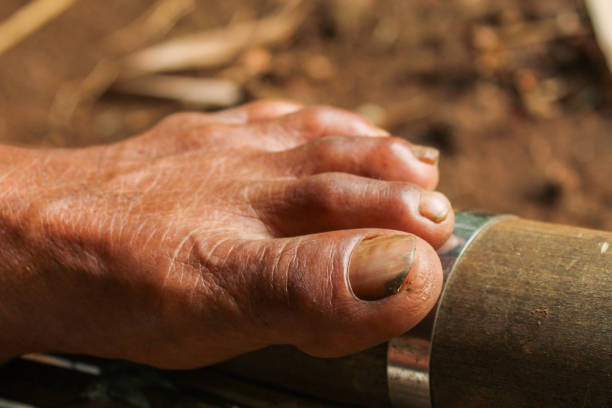 istock close up of old man's legs 2190589191