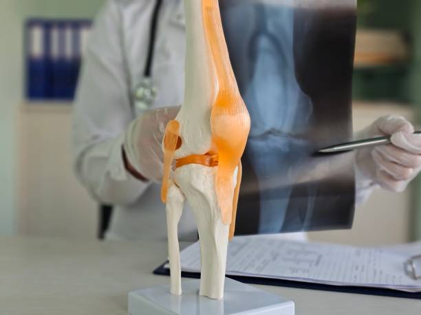 istock Orthopedic surgeon shows knee bone model Explaining to a patient about the treatment of cruciate ligament injury in the knee 2190777659