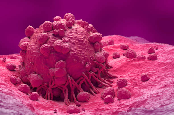 istock Melanoma - closeup view 3d illustration 2190808161