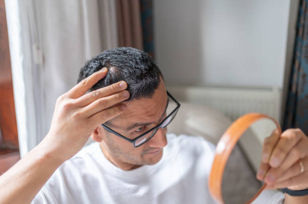 istock Control Of Scalp Lipoma At Home 2191146929