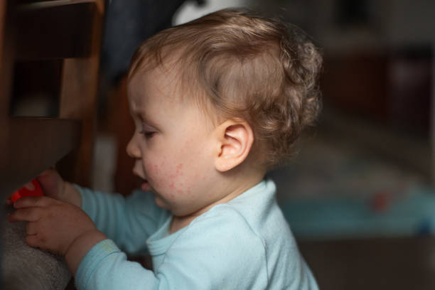 istock Baby with skin rash - exanthem 2191240439