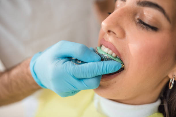 Woman patient undergoing dental treatment, taking an impression for dentures