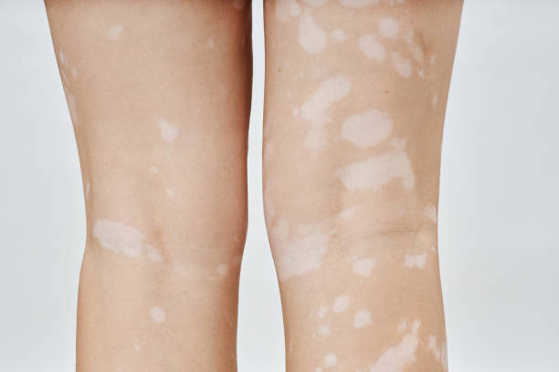 180+ Back Of Knee Close Up Stock Photos, Pictures & Royalty-Free