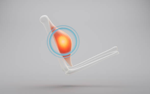 Muscle structure, diseases and medical concept, 3d rendering. 3D illustration.