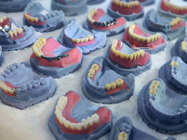 Tooth model, braces model, dental clinic