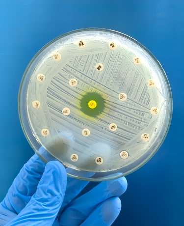 Antimicrobial Testing Sample Antimicrobial Susceptibility Testing In Petri Dish Microbiologist Check ...