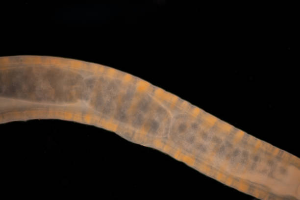 istock Cyctacanth stage (Acanthocephala) fish cestode larva (Trianchoratus sp.) in Channa striata under the microscope in Lab. 2192084091