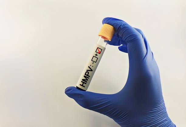 istock Human Metapneumovirus (HMPV) blood test 2192265673