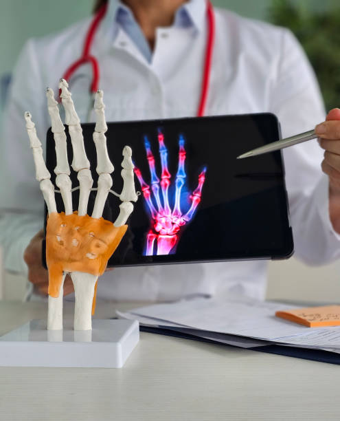 istock Doctors point to x-ray medical imaging with hand bone disease vertical 2192280890