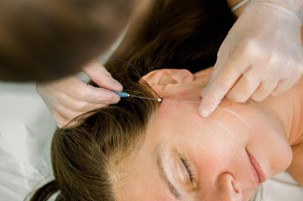 istock Cosmetic procedure with hyaluronic acid and tensor threads 2192372041