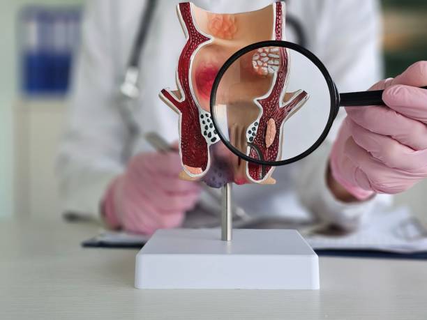 istock Doctor uses magnifying glass to examine rectal model 2192399567