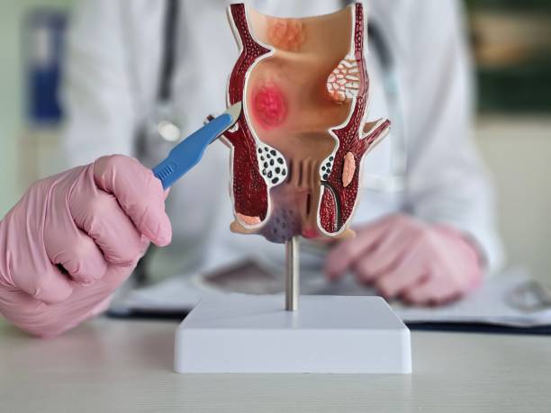 istock Doctor is holding scalpel anatomy of rectum problem 2192399570