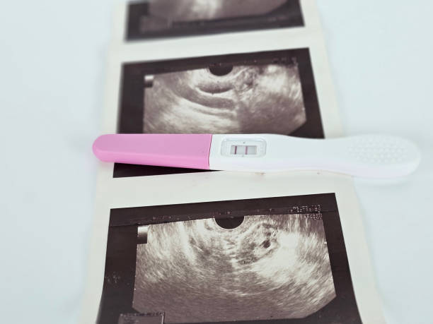 istock Ultrasound images and pregnancy test lying on a table in a bright setting 2192599713