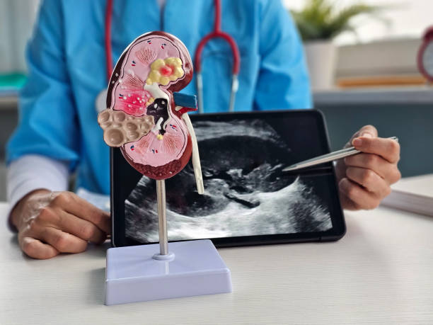 istock Medical professional demonstrating kidney model while discussing ultrasound results 2192673967