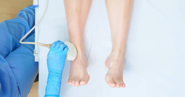 top view asian young female undergoing ultrasound for ankle Achilles tendon injury from sports accident laying on bed in medical examination room - the doctor is sitting by patient