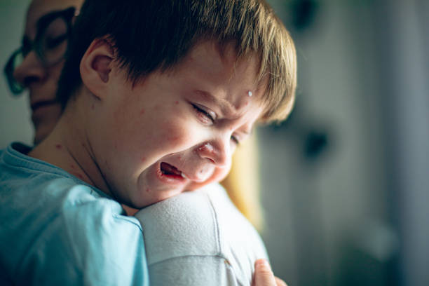 istock Little boy with chickenpox crying on his mothers shoulder 2192778216