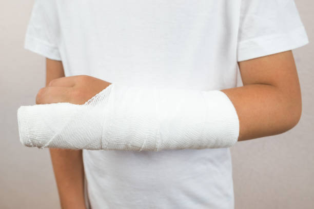 istock broken child's arm in a cast.A boy with a broken arm in a cast.Crop photo. 2193164224