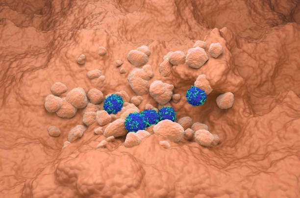 Non Small Cell Lung Cancer (NSCLC) in the lung tissue - isometric view 3d illustration stock photo