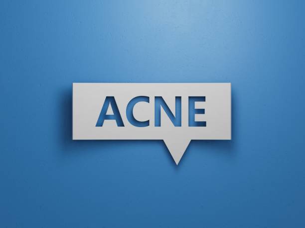 istock ACNE. Text abbreviation on Speech Bubble. Most commonly diagnosed mental disorder of childrenBusiness Concept.3D rendering on blue background. 2193222500