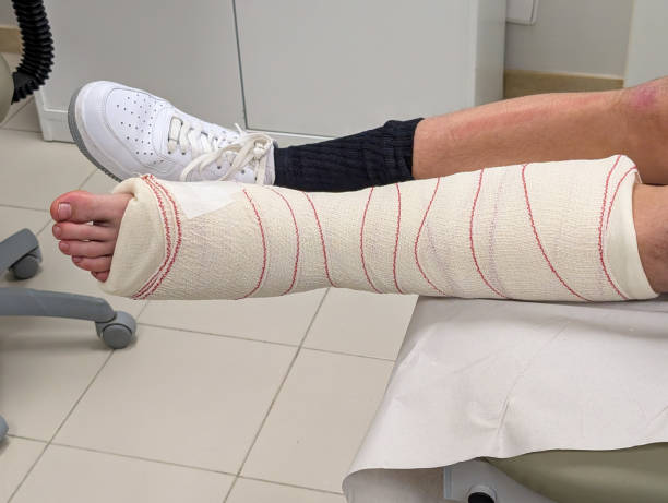 istock Leg in Orthopedic Cast with Support Bandage Resting on Examination Table 2193397056