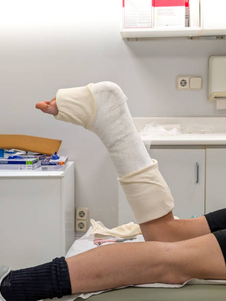 istock Leg with Fresh Cast Elevated for Final Adjustment in Clinic 2193397071