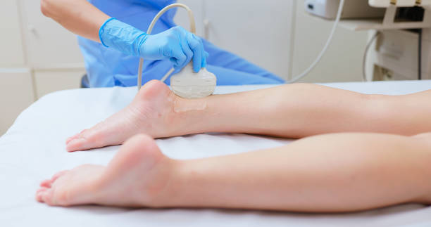 side view closeup asian young female undergoing ultrasound for ankle injury from sports accident lying down bed in medical examination room - she might has Achilles tendon hurt