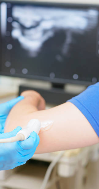 istock asia man elbow injury ultrasound 2193535396