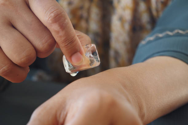 istock woman rubbing ice cube on his hand. 2193624080