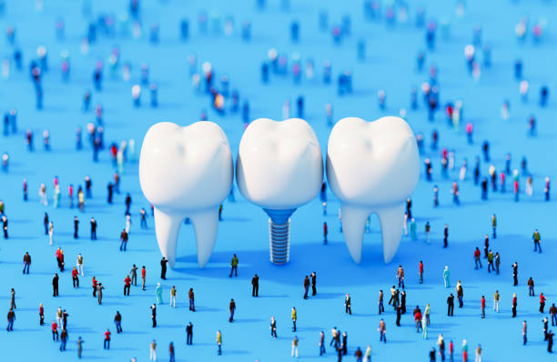 istock Dental Implants Surrounded By Human Crowd On Blue Background - Dental Health Concept 2193660022