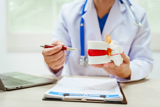 istock A male doctor wearing glasses sits at a desk, explaining a spine model, discussing spinal anatomy, degenerative diseases, nerve compression, back pain, osteoporosis, muscle weakness,reduced mobility 2193685110
