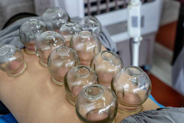 cupping glass