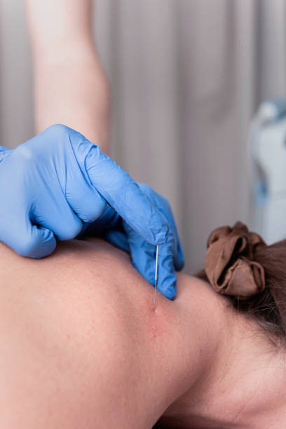 istock Physiotherapist treats a patient 2193815717