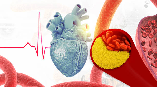 istock Human heart blocked artery 2193819176