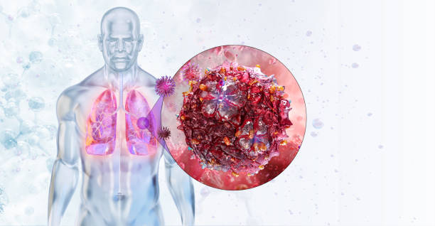 istock Lung infection caused by single stranded RNA rhinovirus 2193840393