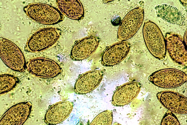 istock The eggs of Trichuris trichiura in stool specimen analysed by microscope. 2193853512