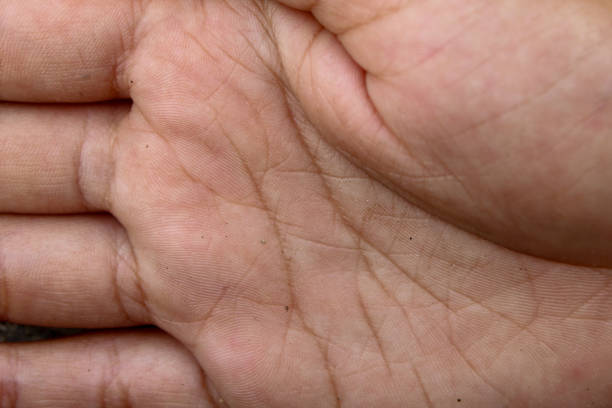 Above view of child's hand wrinkled and shriveled due to the long stay in the water against sea water