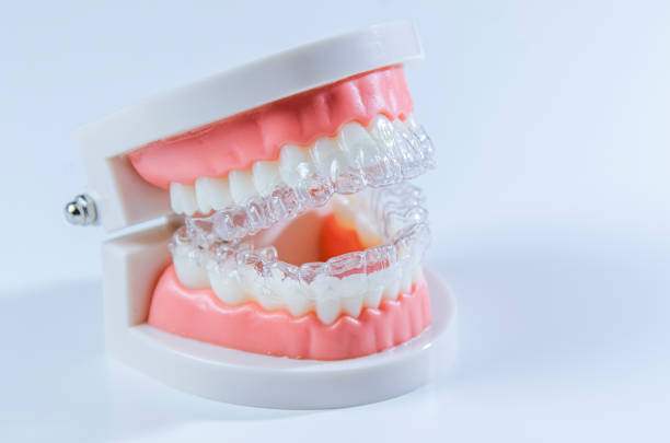 istock Close-up. Transparent aligners for artificial jaw teeth on a white background 2194348017