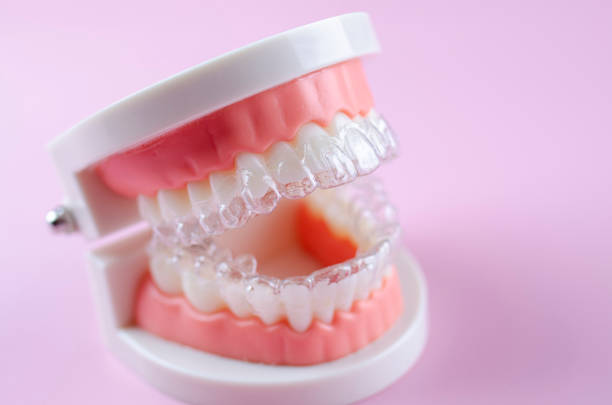 istock Invisible and removable aligners for teeth alignment on a pink background 2194348201