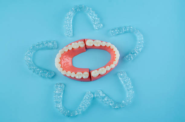 istock Close-up. Transparent aligners for artificial jaw teeth on a blue background 2194353428