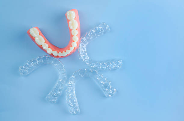 istock Invisible dental teeth brackets tooth aligners on blue background. Plastic braces dentistry retainers to straighten teeth 2194354727