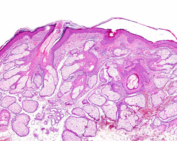 istock Human skin. Sebaceous glands 2194419991