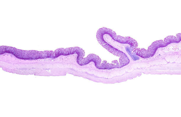 istock Human colon. Large intestine wall 2194420010