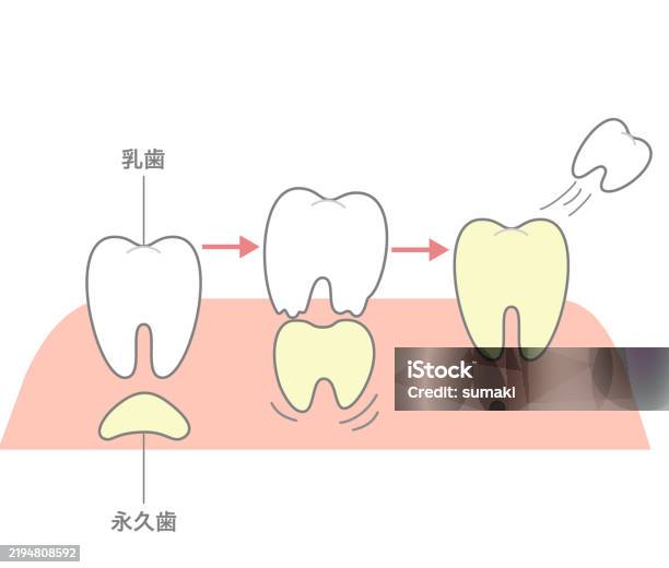 The Process Where Permanent Teeth Push Through And Replace Baby Teeth ...