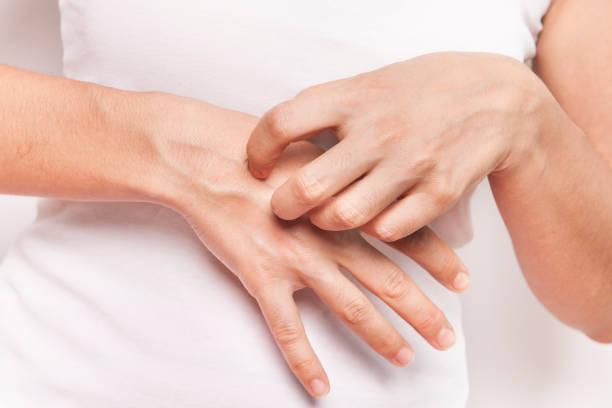 istock The woman is scratching her hand. 2195298092