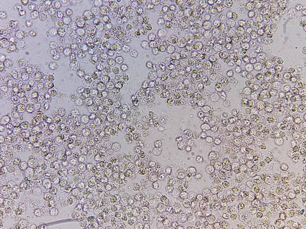 istock Semen analysis, sperm analysis on microscopic examination, Normozoospermia. 2195407417