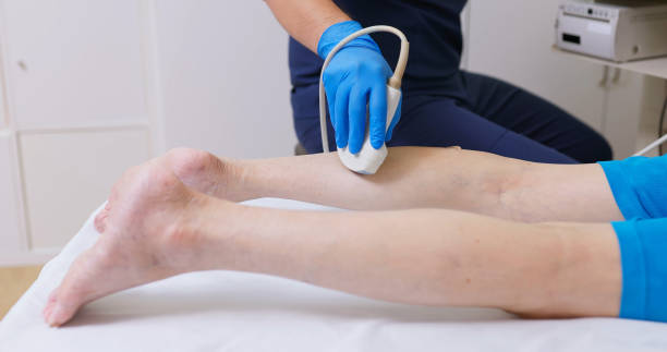 istock asia Doctor Perform calf Ultrasound 2195445152