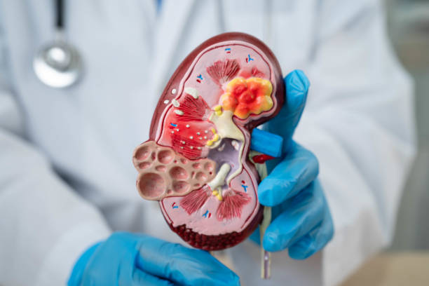istock Chronic kidney disease, doctor with model for treatment urinary system, urology, Estimated glomerular filtration rate eGFR. 2195607093